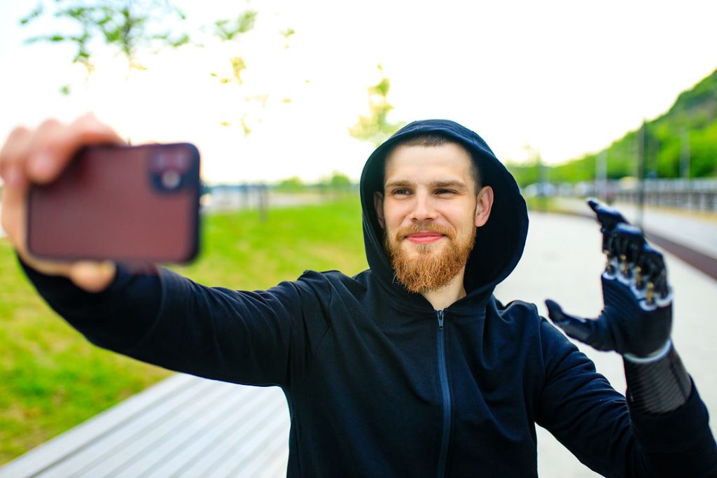 Person with an amputated hand taking a selfie